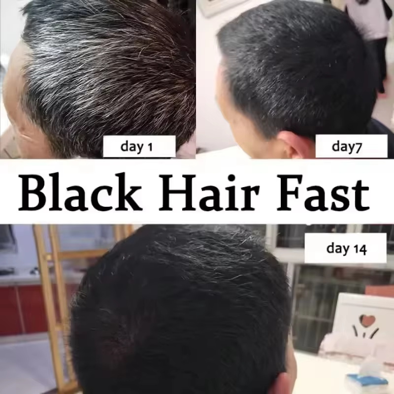 Suero para el Cabello Blanco y - Hair Care Ginseng reseña y precio