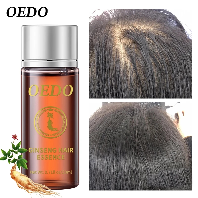 Esencia para el crecimiento de - Hair Care Ginseng reseña y precio