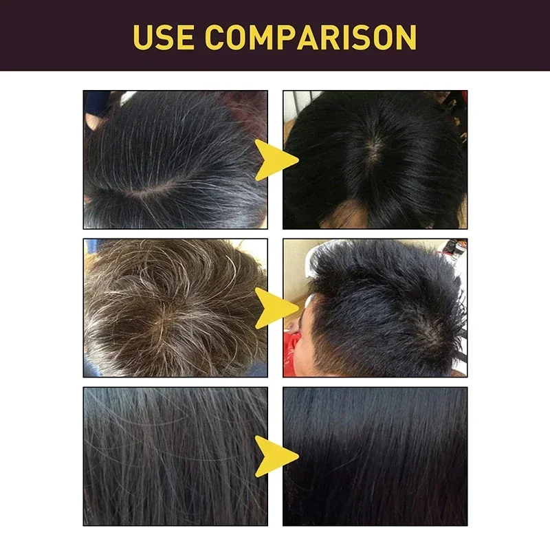 Champú para teñir el cabello d - Hair Care Loreal reseña y precio