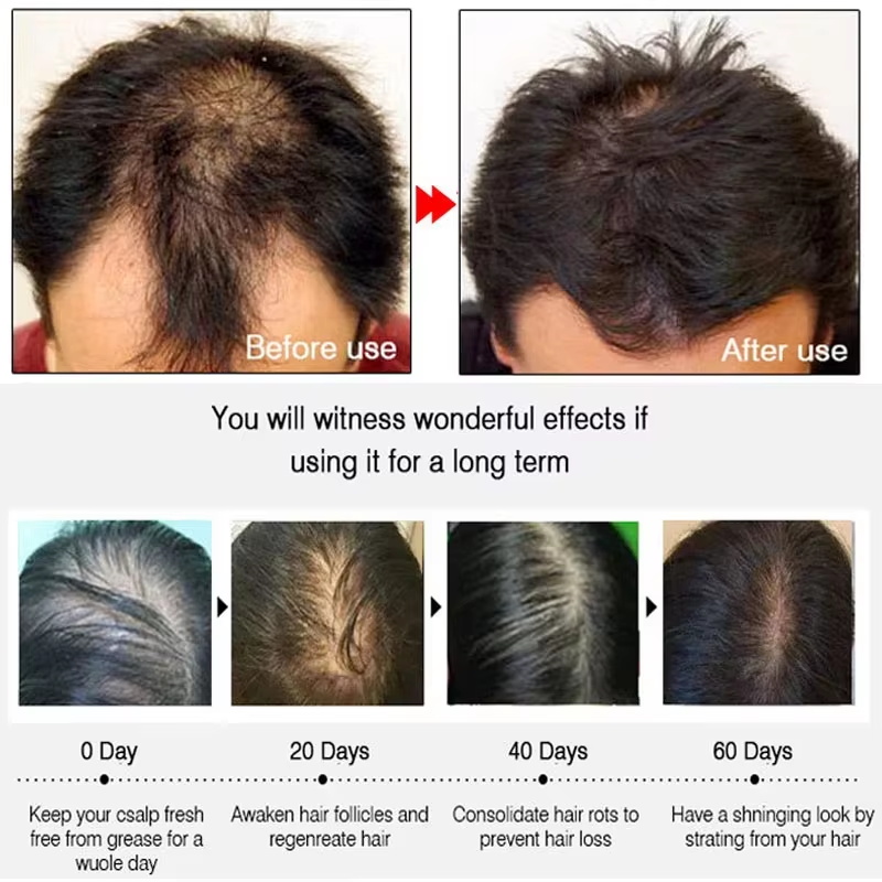 Spray de Crecimiento Rápido de - Hair Care Growth reseña y precio